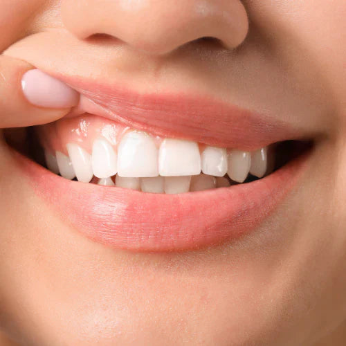 Jak funguje bělení zubů a které produkty si vybrat